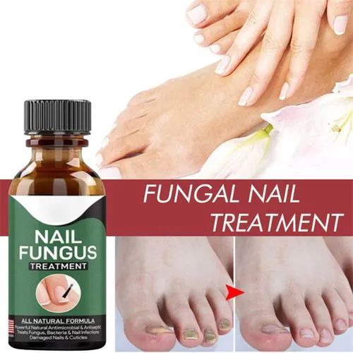 Nail Fungal Treatments Nail Repair Essences Serum
