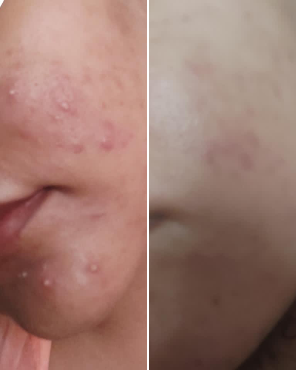 Nirvana Botanics Vitamin C + E Serum