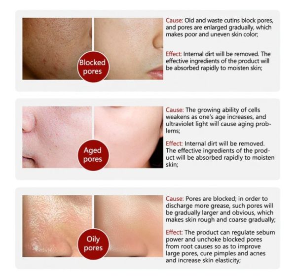 Anti Wrinkle Rice Face Serum